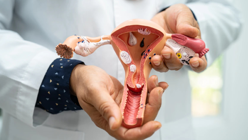 uzmani anlatti her on kadindan birinde polikistik over sendromu gorulebilir uZ5uFVSK